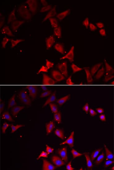 PCBD1 / PHS Antibody