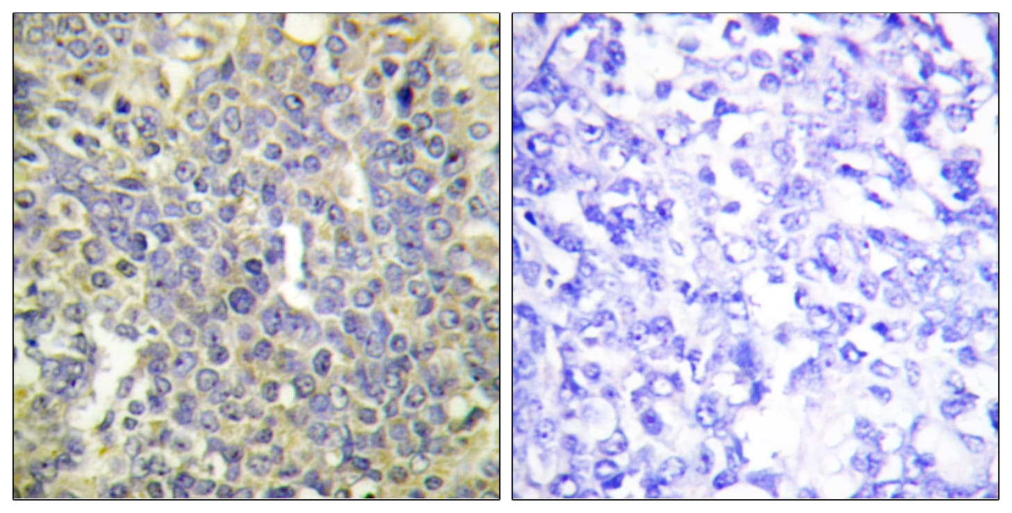 Polyclonal Rabbit anti-Human CASP9 / Caspase 9 Antibody (phospho-Thr125, IHC, WB)