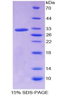 Human HPR Protein (Recombinant His)