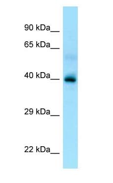 Polyclonal Rabbit anti-Human P2Y13 / P2RY13 Antibody (aa229-278, WB)
