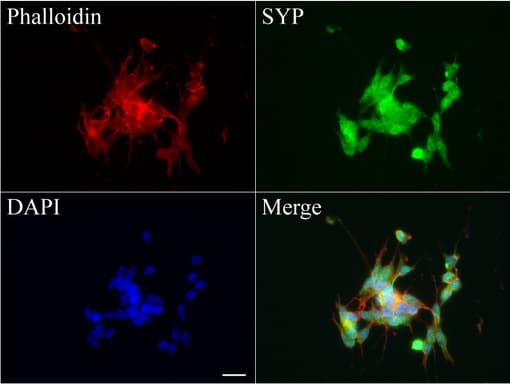 Monoclonal Mouse anti-Human SYP / Synaptophysin Antibody (clone UMAB112, Carrier-free, IHC, IF, WB)