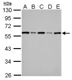 FKBP4 / FKBP52 Antibody (aa1-207)