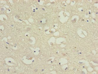 Polyclonal Rabbit anti-Human CKLFSF5 / CMTM5 Antibody (IHC)
