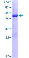 Human TTC9B Protein (Recombinant GST)