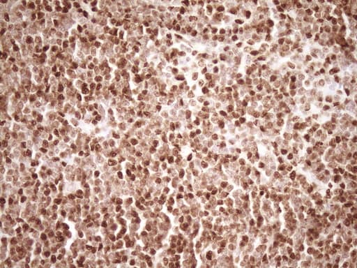SAE1 Antibody (clone OTI6C7)