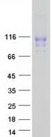Human VASN / Vasorin Protein (Recombinant Myc-DDK (Flag))