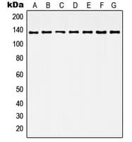Polyclonal Rabbit anti-Human HDAC6 Antibody (C-Terminus, IHC, IF, WB)