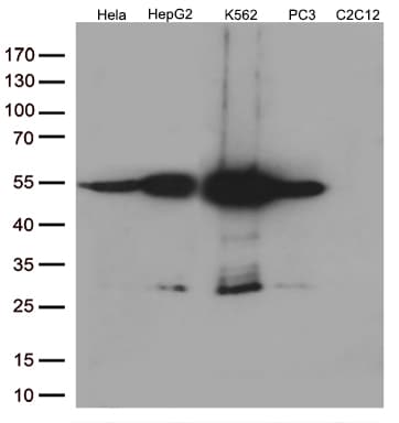 CALR / Calreticulin Antibody (clone OTI13H4)