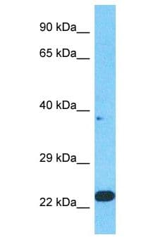 Polyclonal Rabbit anti-Human CPSF3L Antibody (aa35-84, WB)