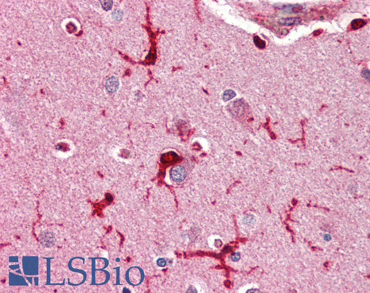 IHC-plus™ GPX1 / Glutathione Peroxidase Antibody (aa130-142)