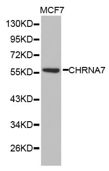 Monoclonal Rabbit anti-Human CKMT2 Antibody (WB)