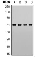 Polyclonal Rabbit anti-Human ADRA1A Antibody (C-Terminus, IHC, IF, WB)