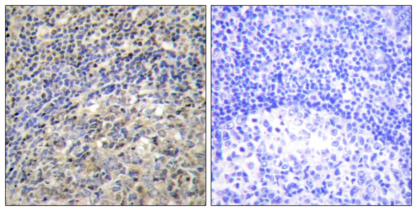 NCF1 / p47phox / p47 phox Antibody (p370)