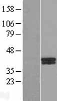 B4GALT7 Protein (Over-Expression Lysate Myc-DDK (Flag))