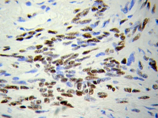 HDAC4 Antibody