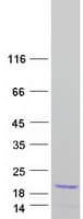 Human MAX Protein (Recombinant Myc-DDK (Flag))