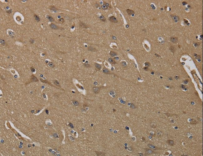 Polyclonal Rabbit anti-Human KLK6 / Kallikrein 6 Antibody (IHC, WB)