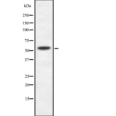 IFIT1B Antibody
