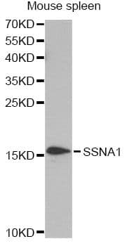 SSNA1 Antibody