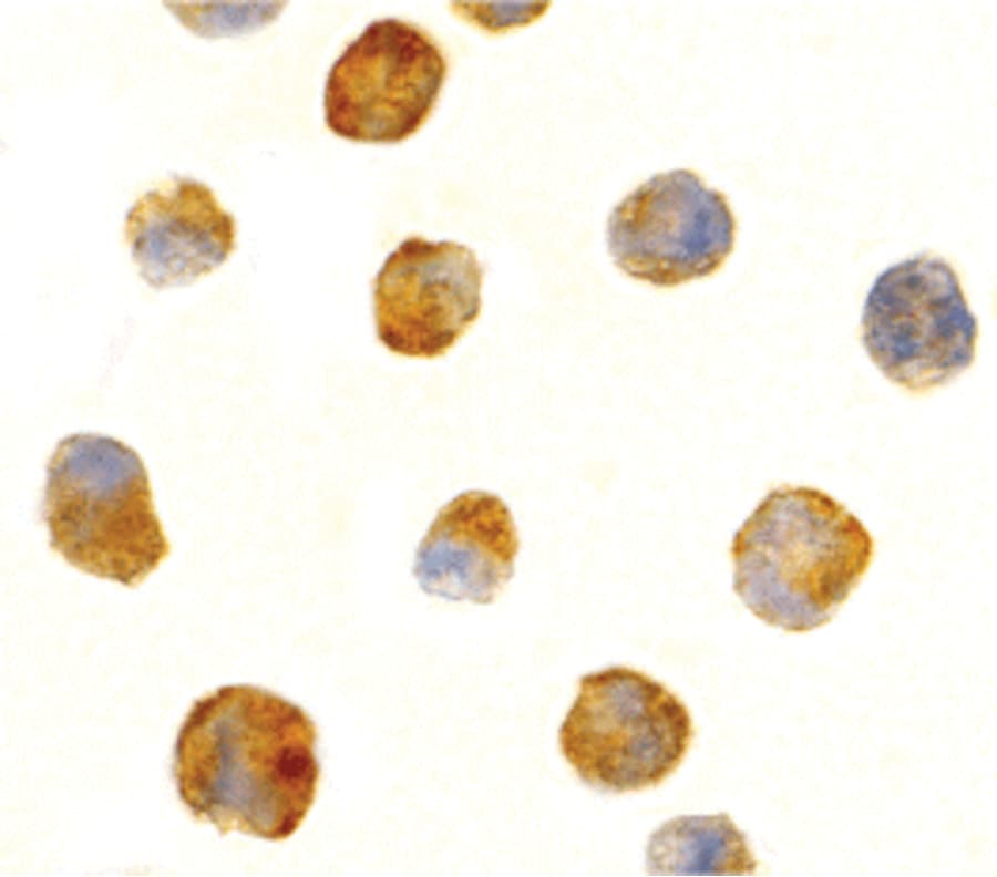 ANTXR1 / TEM8 Antibody