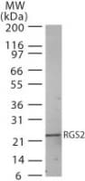 IHC-plus™ RGS2 Antibody (aa1-50)