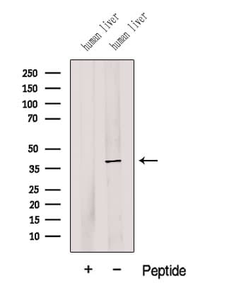 G6PC / Glucose-6-Phosphatase Antibody