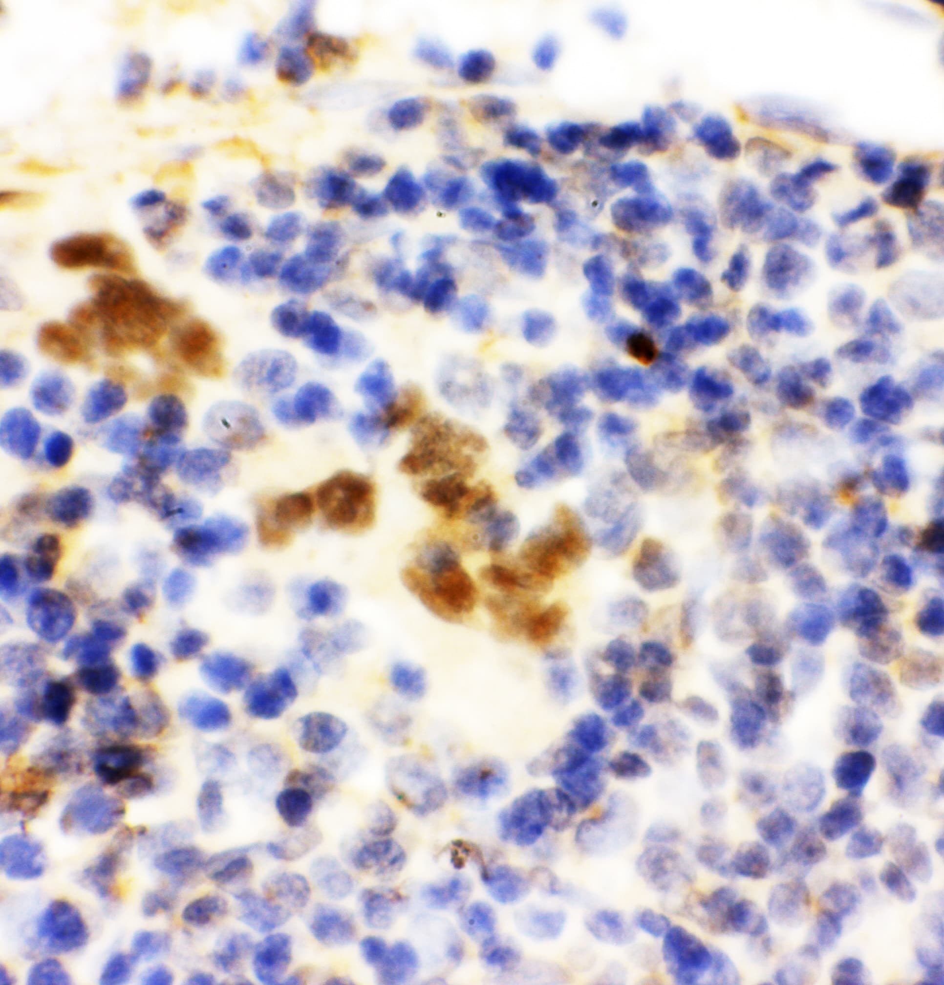 FLI1 Antibody (aa54-73)