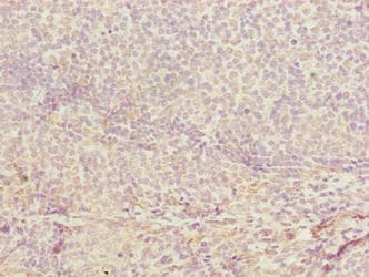 Polyclonal Rabbit anti-Human CDADC1 Antibody (IHC)