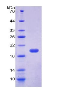 Human SUPT6H / SPT6 Protein (Recombinant His-T7)