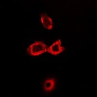 CRAT Antibody