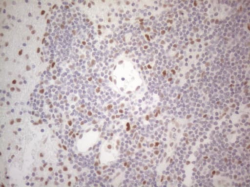 HDAC2 Antibody (aa415-488, clone OTI7E10)