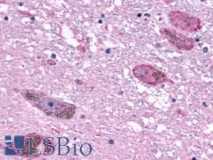PathPlus™ Encephalopsin / OPN3 Antibody (C-Terminus)