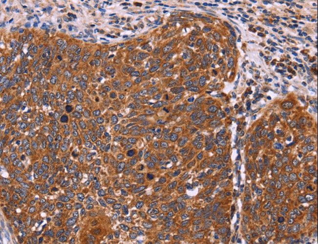 FBXW7 / FBW7 Antibody