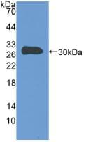 TLN1 / Talin 1 Antibody (aa2293-2536)