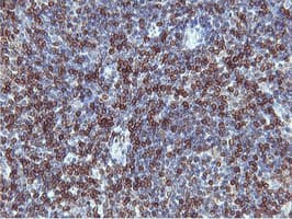 APMAP / C20orf3 Antibody (clone OTI3F2)