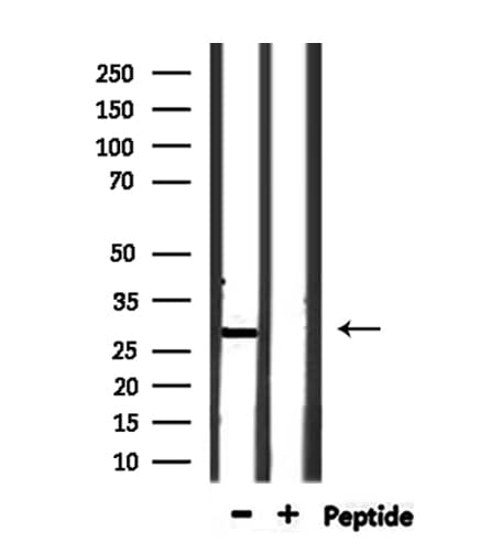 Polyclonal Rabbit anti-Human OAZ3 Antibody (WB)