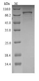 Rat SEMA3A / Semaphorin 3A Protein (Recombinant 6His, N-terminus)