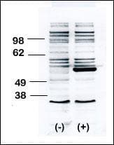BLK Antibody (aa1-30)