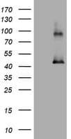 MAGEA3 Antibody (clone OTI2B1)