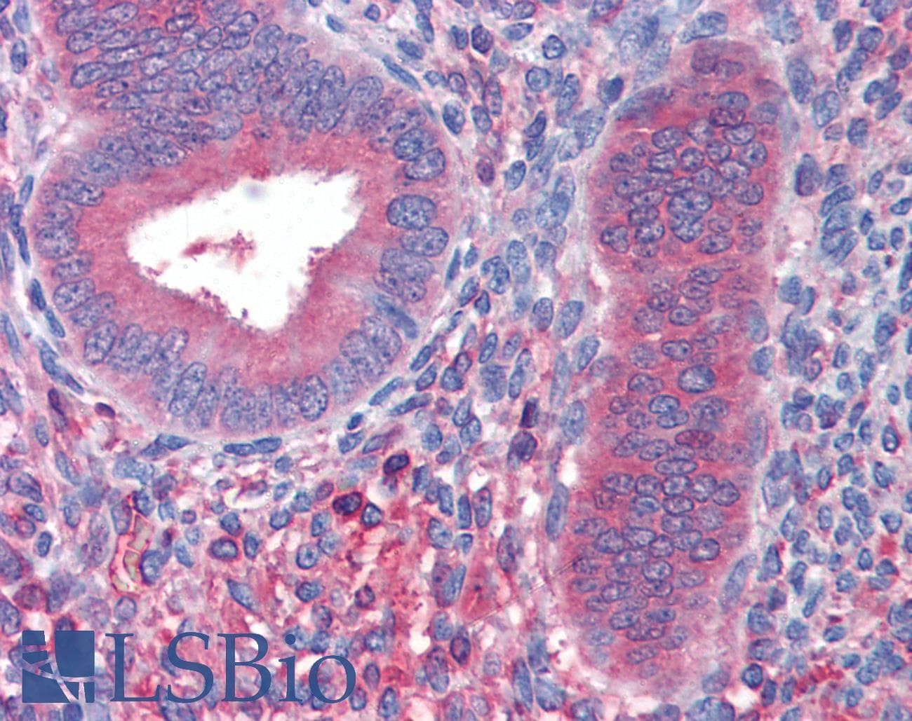 IHC-plus™ Monoclonal Mouse anti-Human FGB / Fibrinogen Beta Chain Antibody (clone 1F9, IHC, WB)