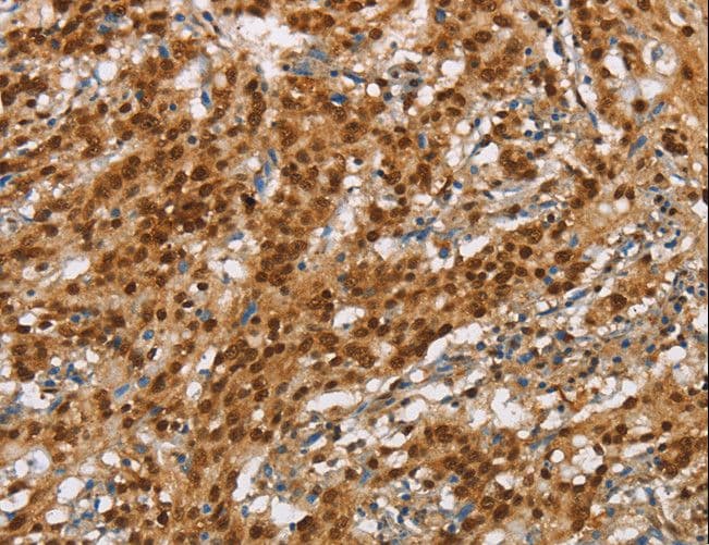 Polyclonal Rabbit anti-Human NLRP7 / NALP7 Antibody (IHC)