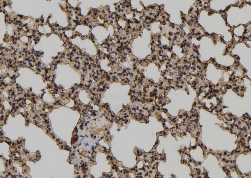 TCEAL2 Antibody