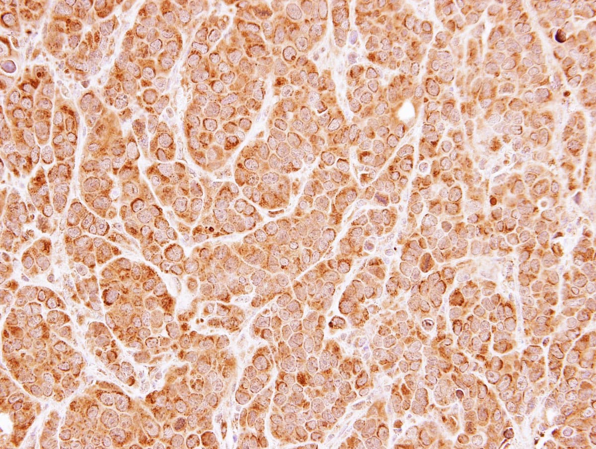 UNC13B Antibody (aa462-749)