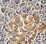 PRSS3 / Trypsin 3 Antibody (aa13-40)