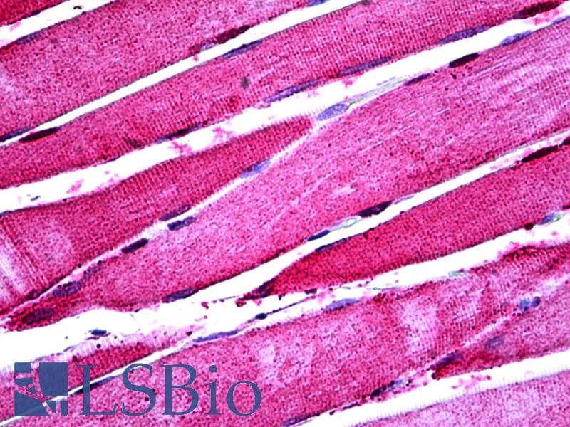 IHC-plus™ ENO3 / Enolase 3 Antibody (clone 5D1)
