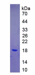 Mouse AQP4 / Aquaporin 4 Protein (Recombinant His)