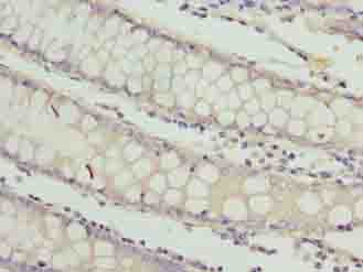 RAB3B Antibody