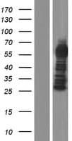 CXorf49B Protein (Over-Expression Lysate Myc-DDK (Flag))