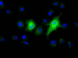 EFNA2 / Ephrin A2 Antibody (clone OTI4C3)