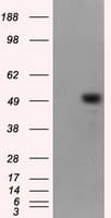 TLDC1 / KIAA1609 Antibody (clone OTI12G10)